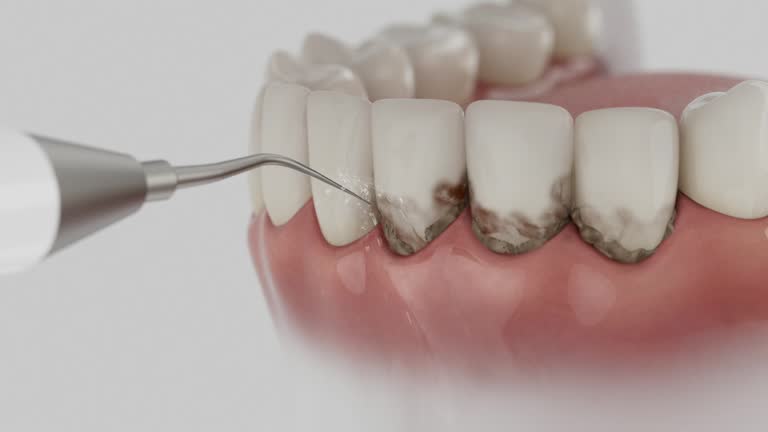 Trusted Invisalign Clear Aligners service in Oxford, NC - Dentist Open Now